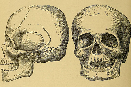 Найдены древнейшие зубные пломбы
